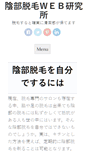 Mobile Preview