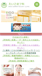 Mobile Preview