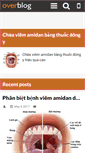 Mobile Preview